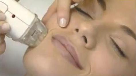 LIPOCERO PAMPLONA:RADIOFRECUENCIA FACIAL. VEN CON UNA AMIGA Y PODREIS PROBARLO GRATIS